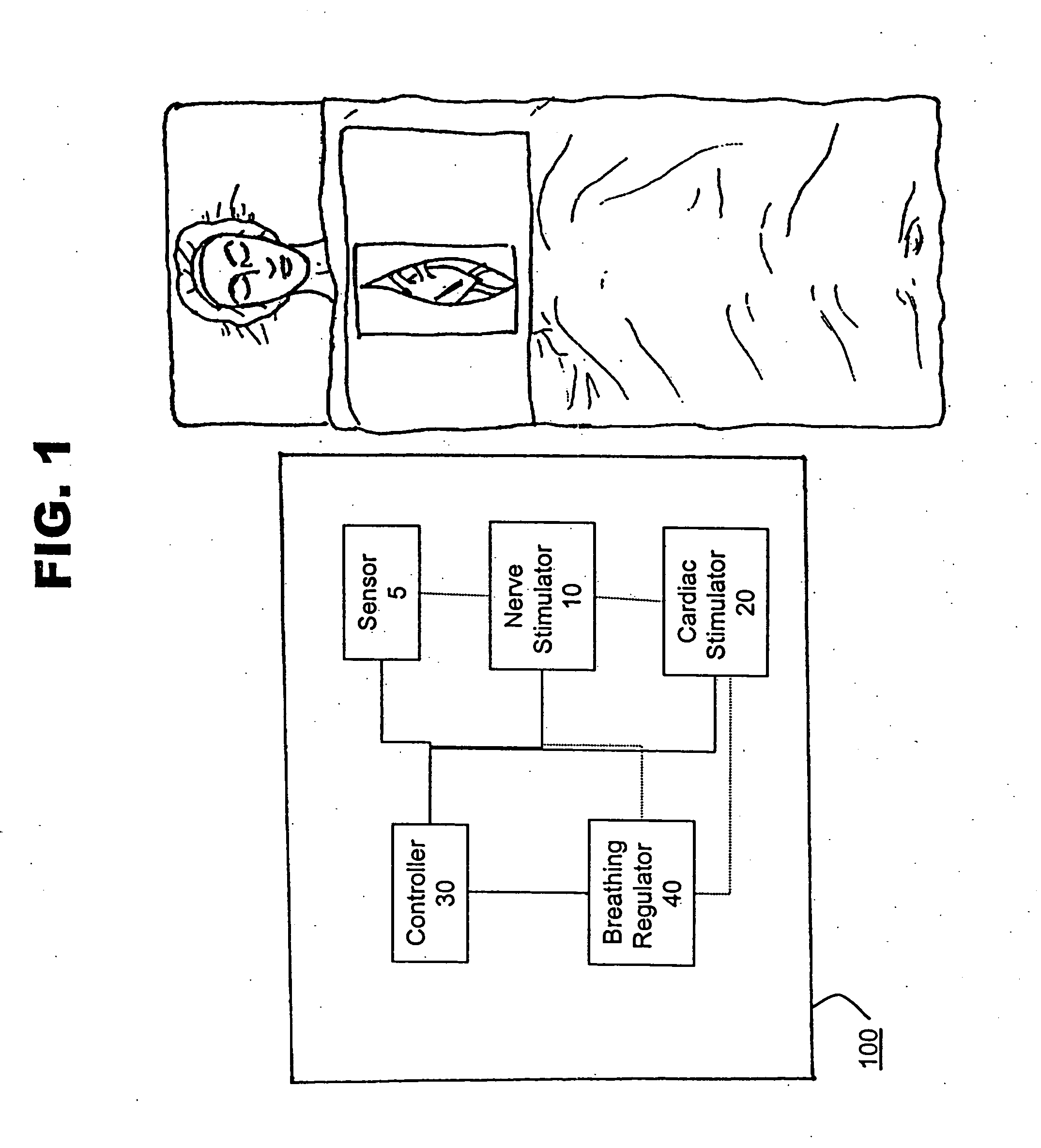 Method and system for monitoring and controlling systemic and pulmonary circulation during a medical procedure