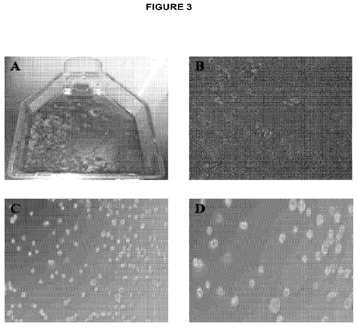 Human disc tissue