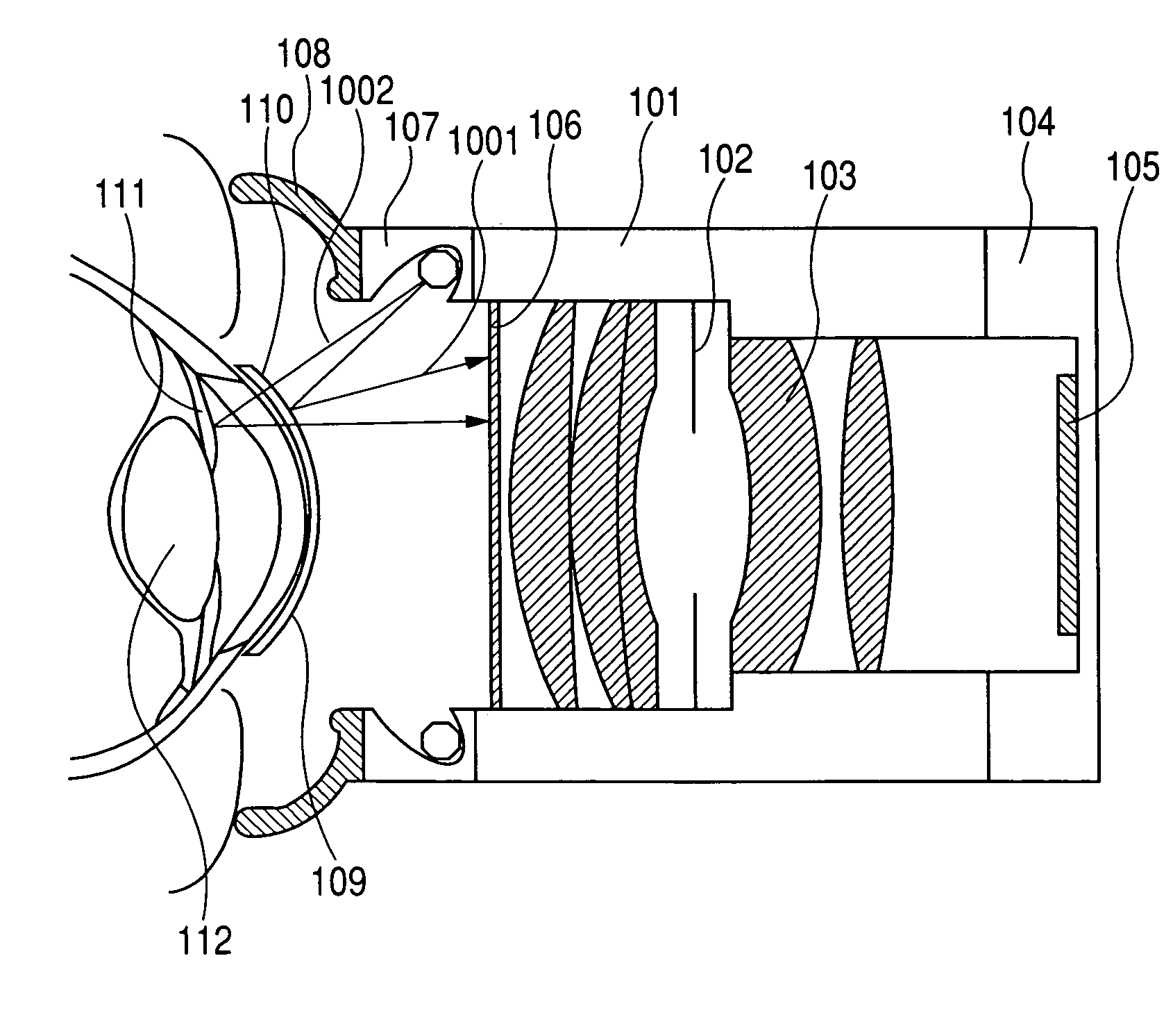 Detection apparatus for detecting an amount of an object of analysis in a fluid present in an eye or on an eye surface