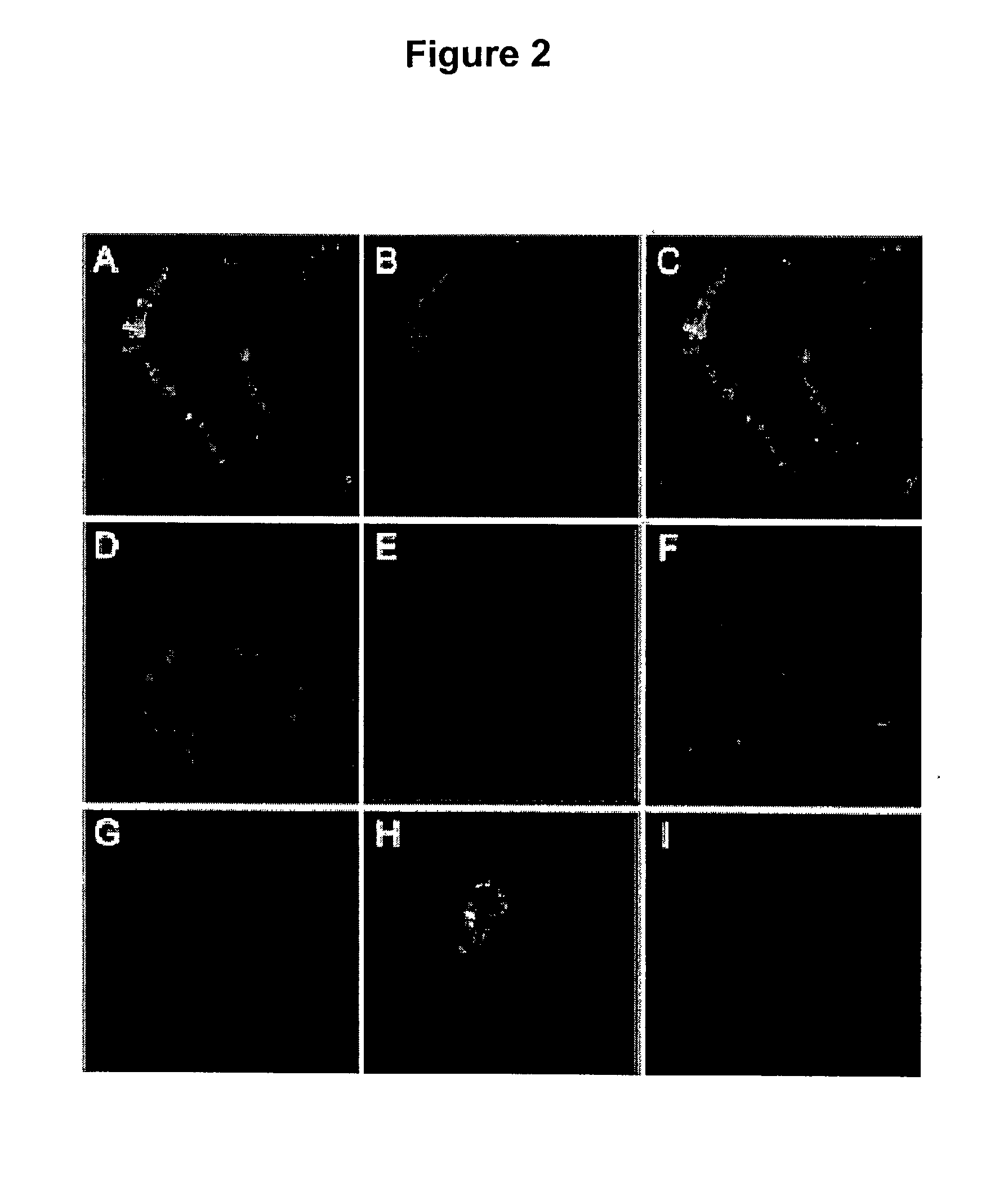 Lipoprotein receptor