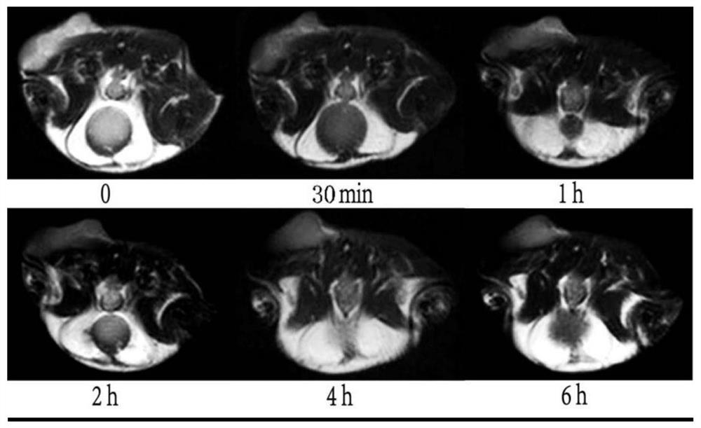 Magnetic resonance molecular probe for detecting early hepatocellular carcinoma