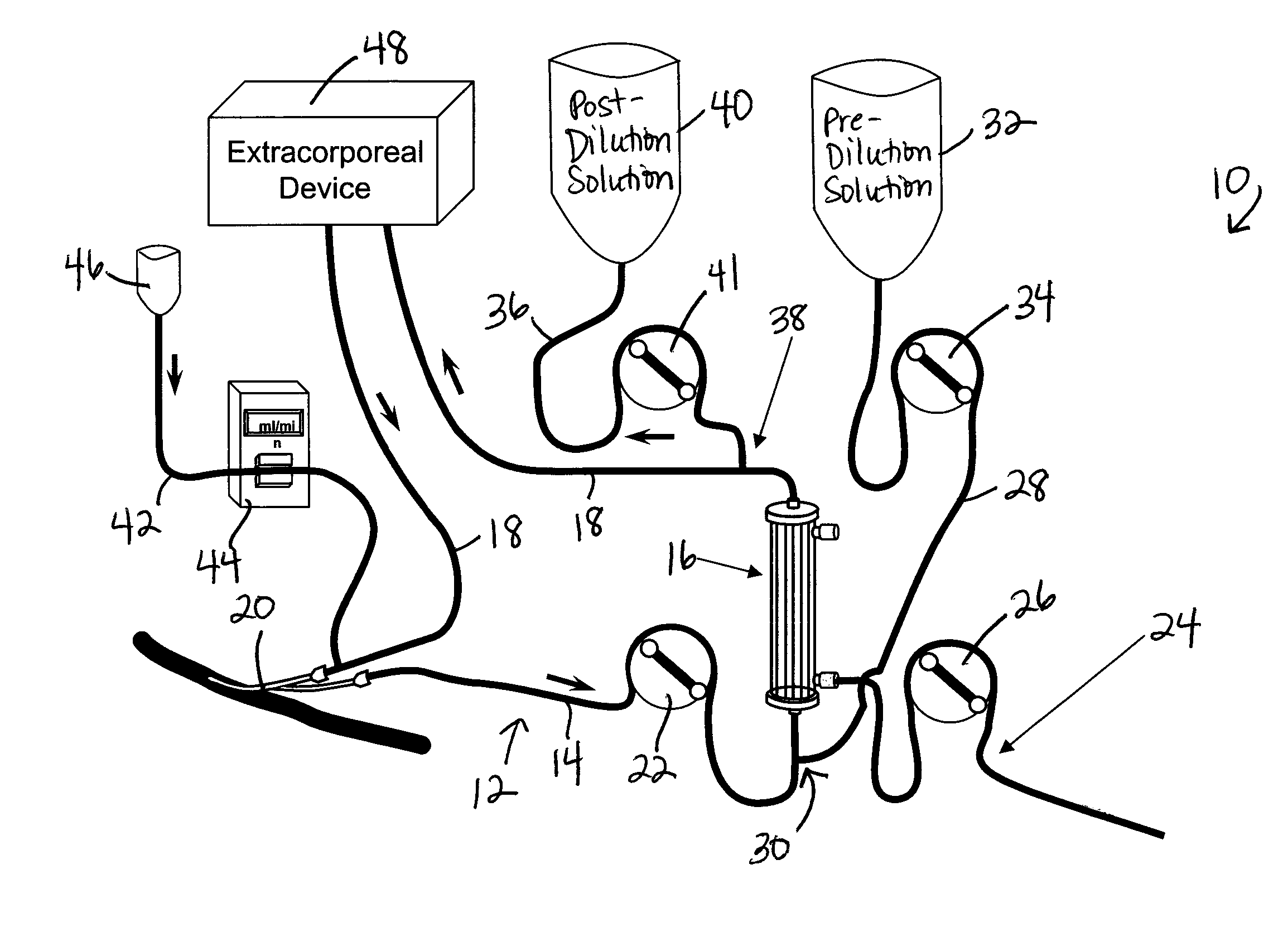 System and method for delivery of regional citrate anticoagulation to extracorporeal blood circuits