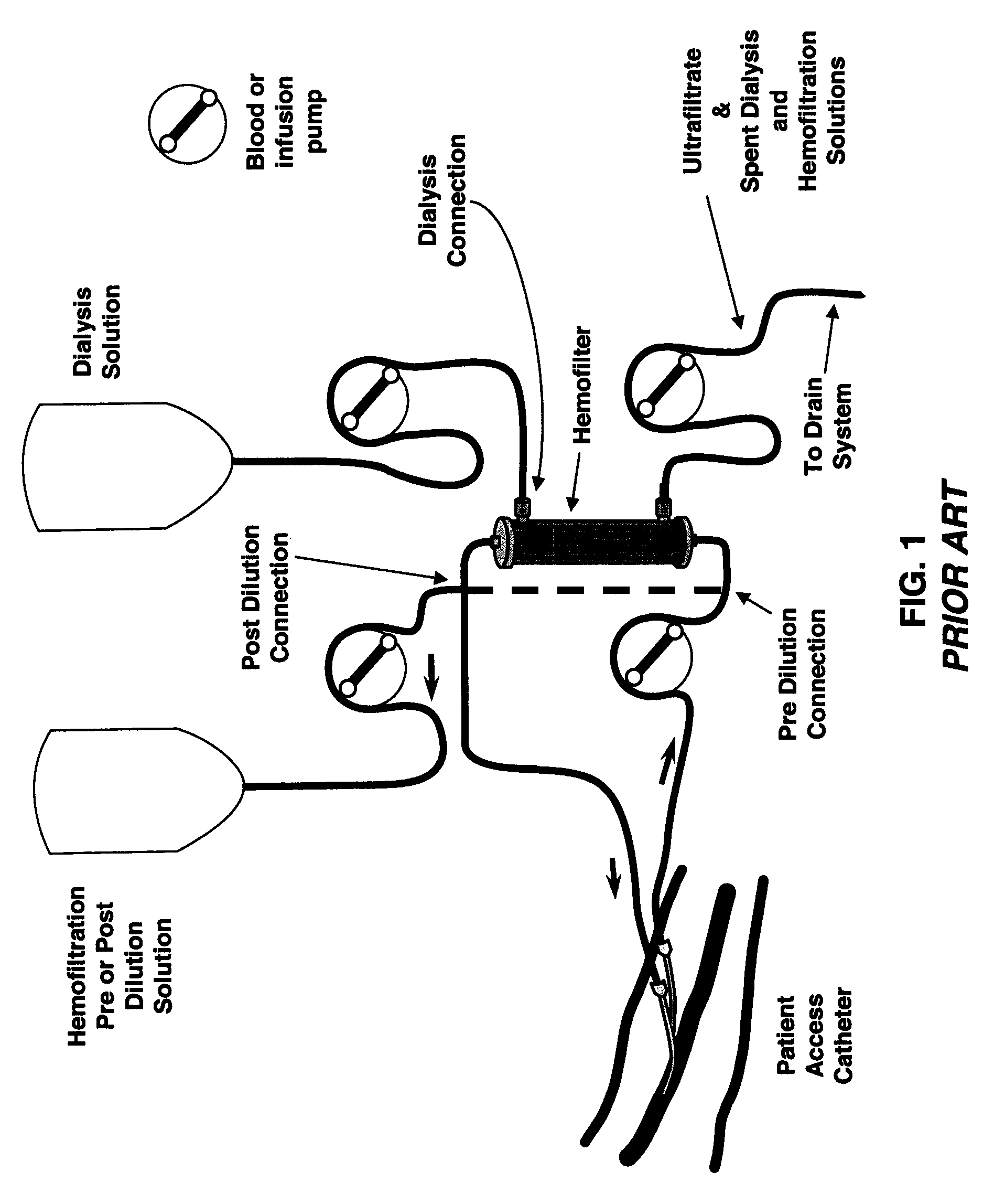 System and method for delivery of regional citrate anticoagulation to extracorporeal blood circuits