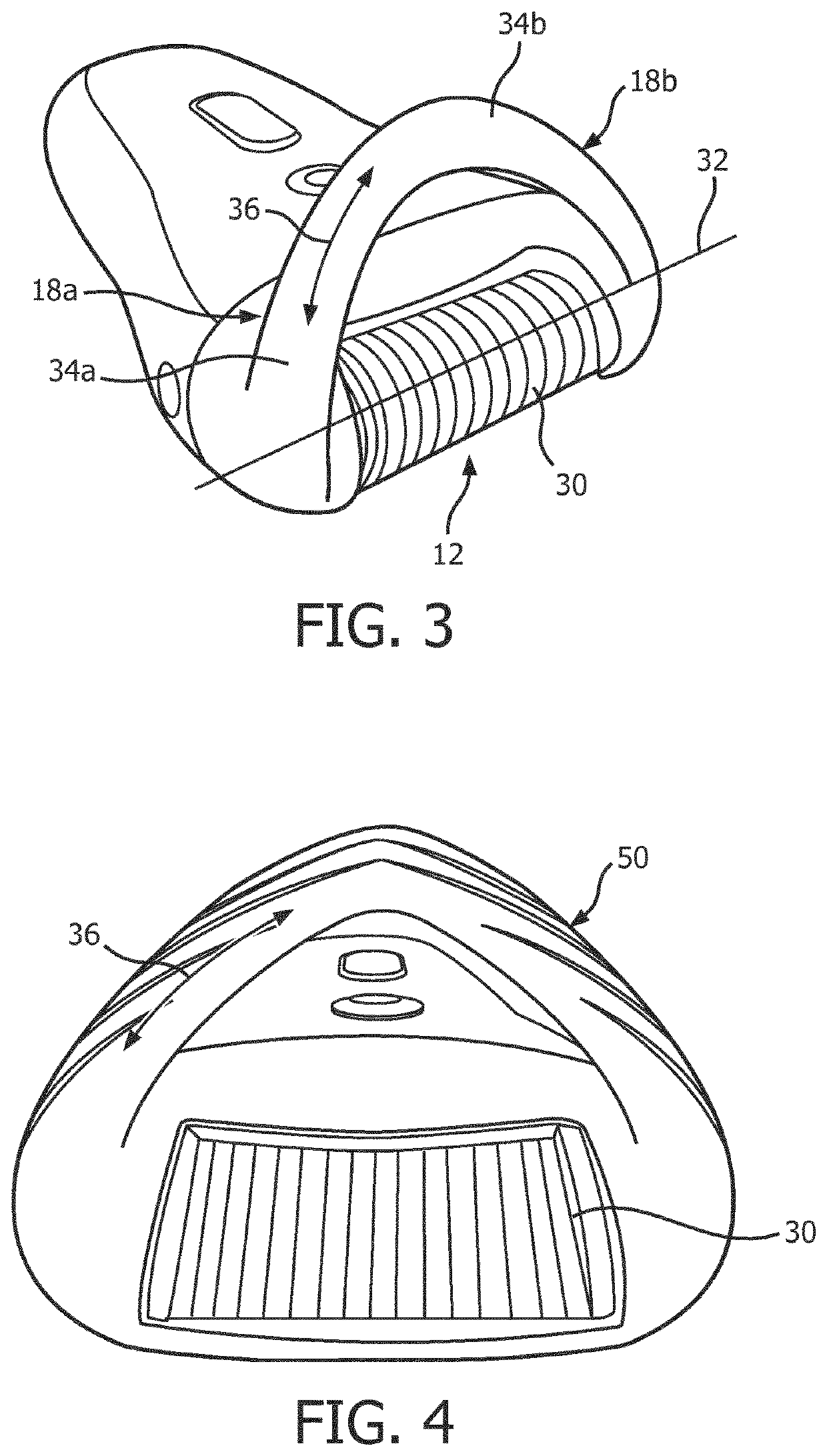 Hair removal apparatus