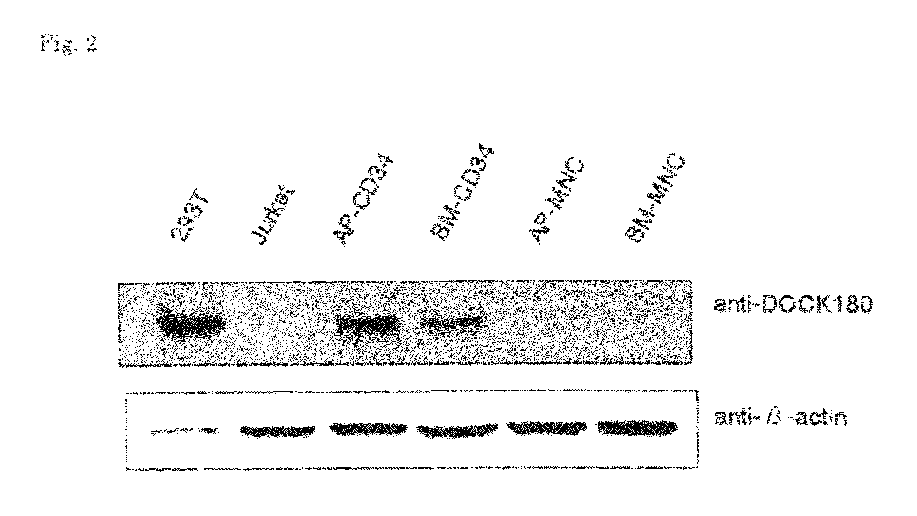 Method of detecting leukemic cell