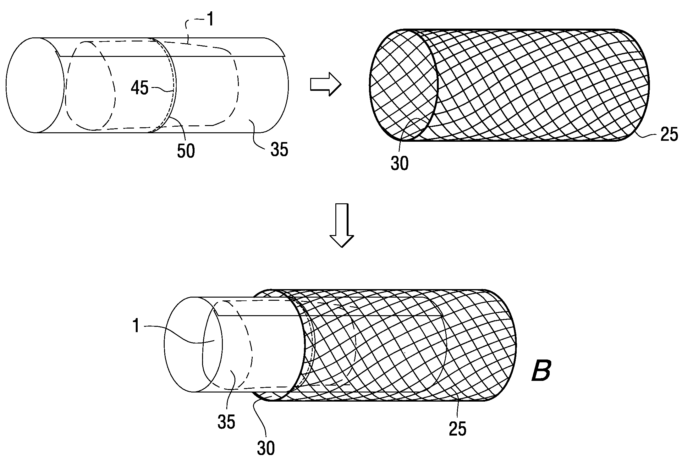 Meat trussing system