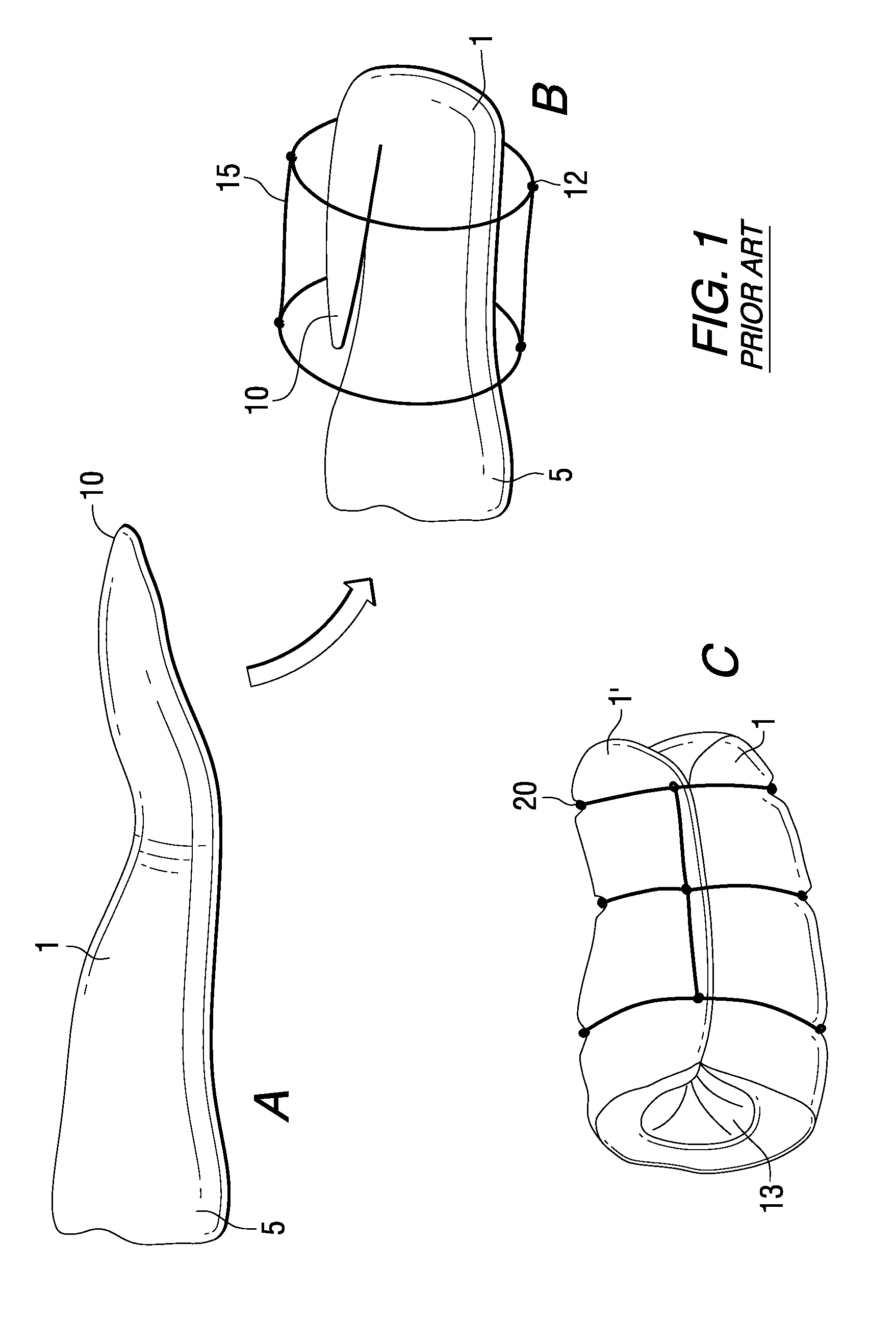 Meat trussing system