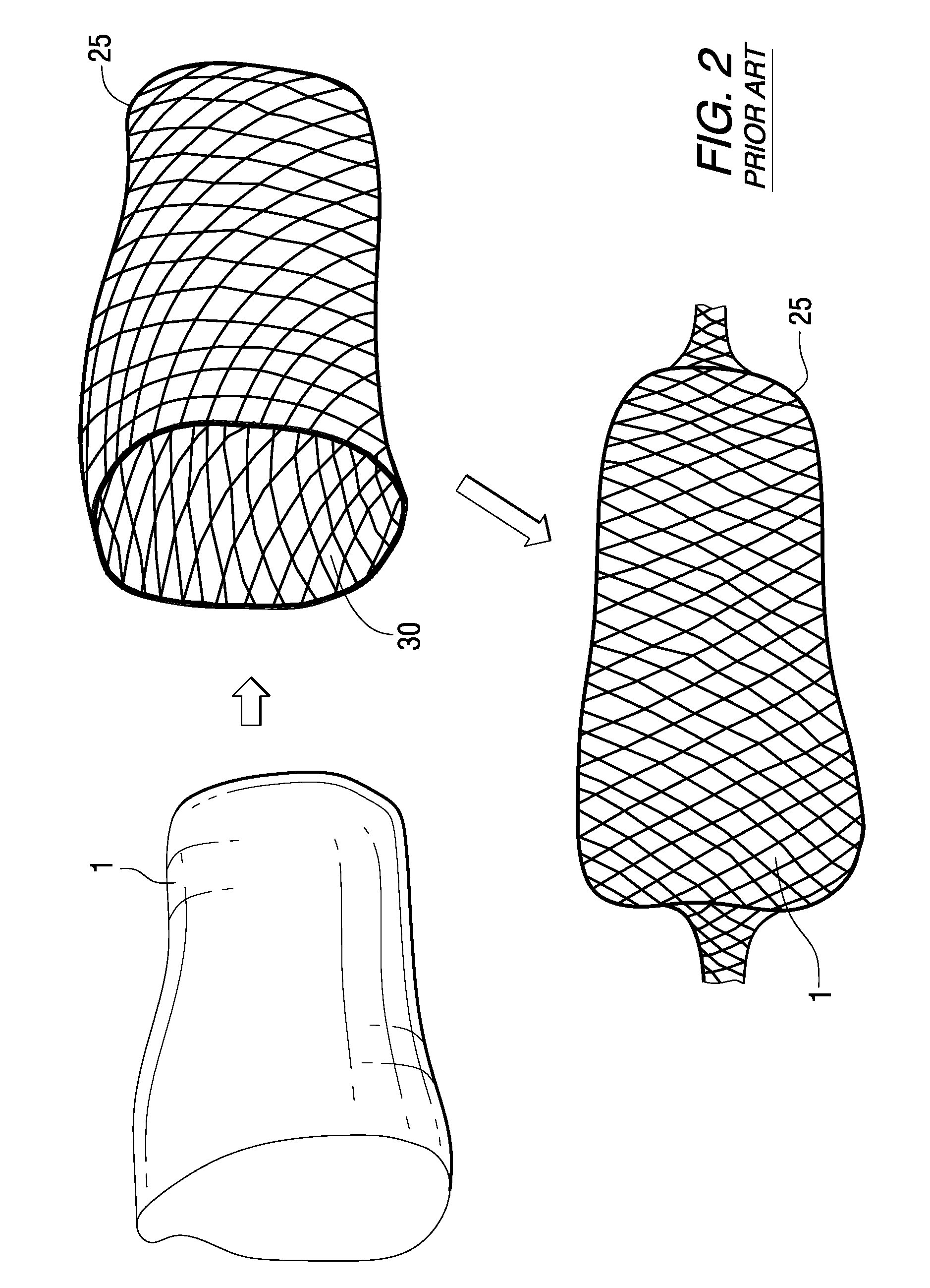 Meat trussing system