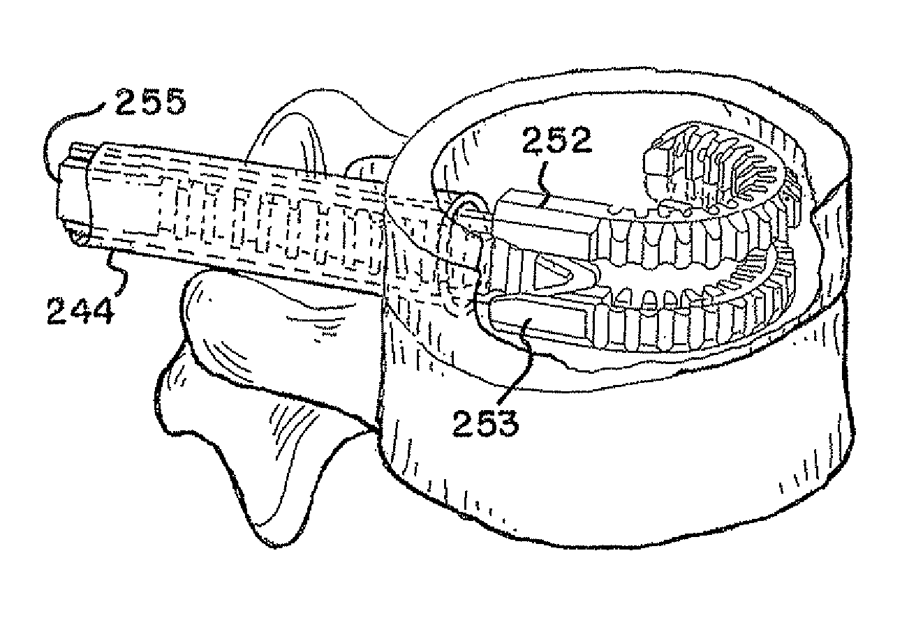 Devices for treating the spine