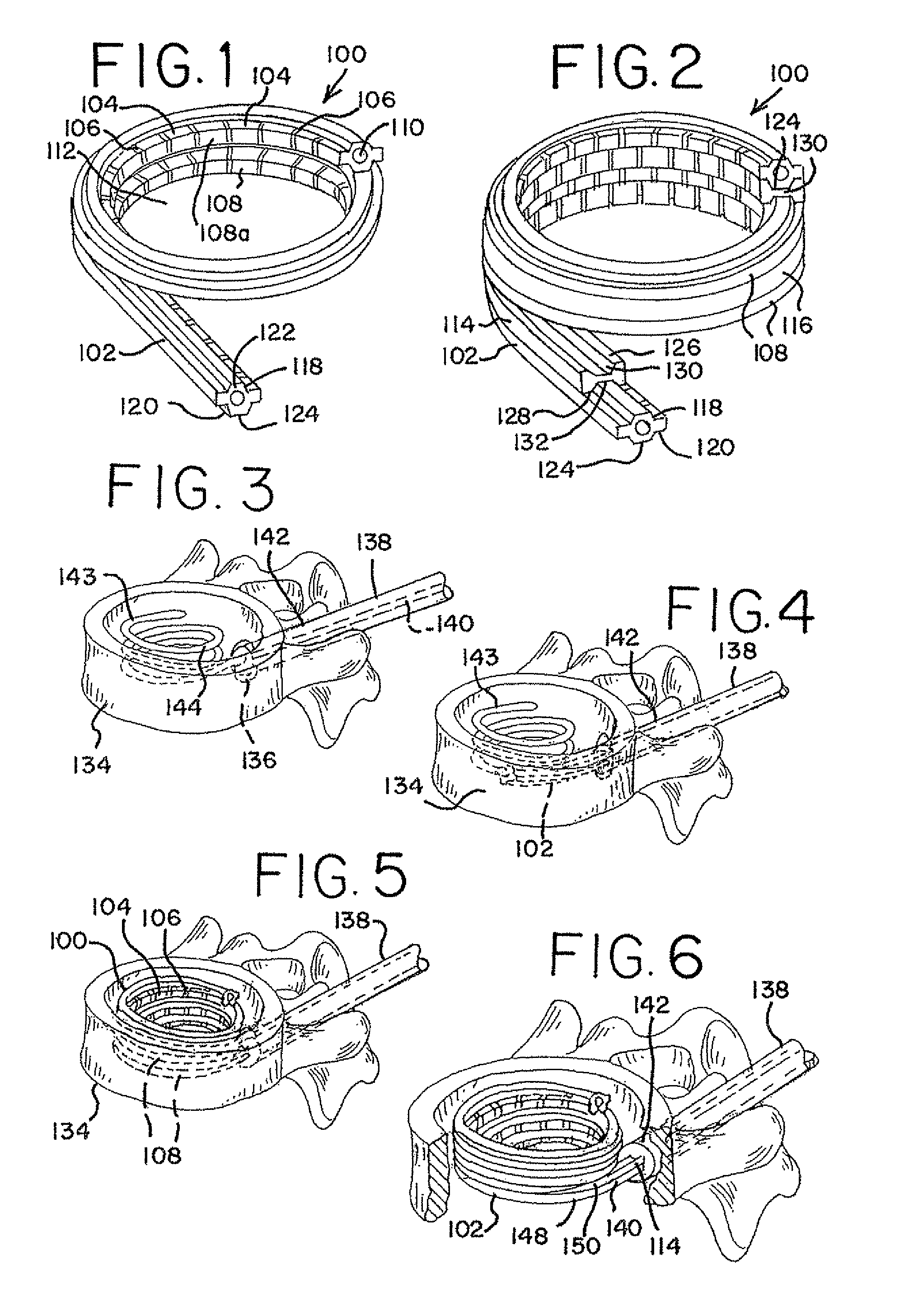 Devices for treating the spine