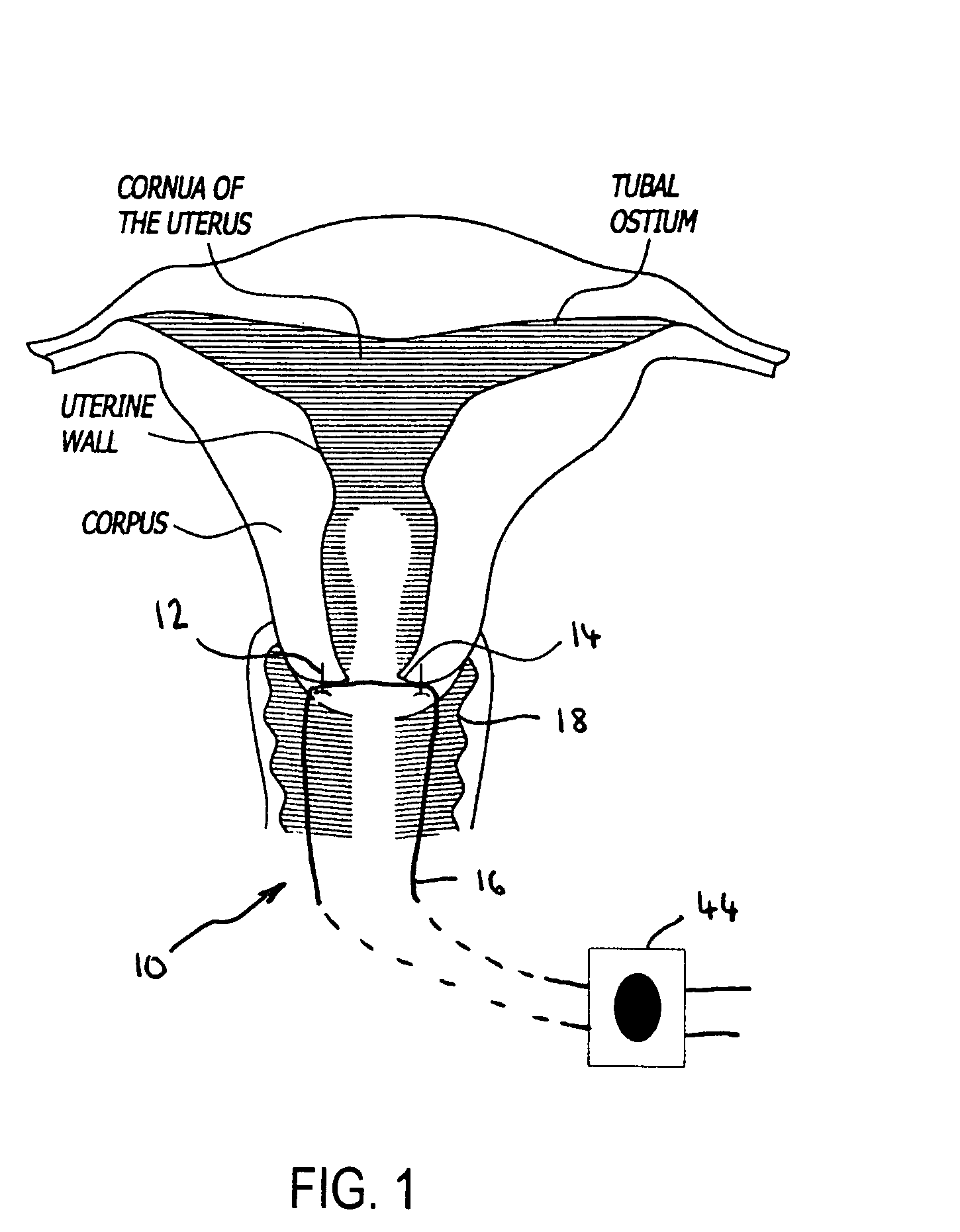 Systems and methods for measuring cervical dilation