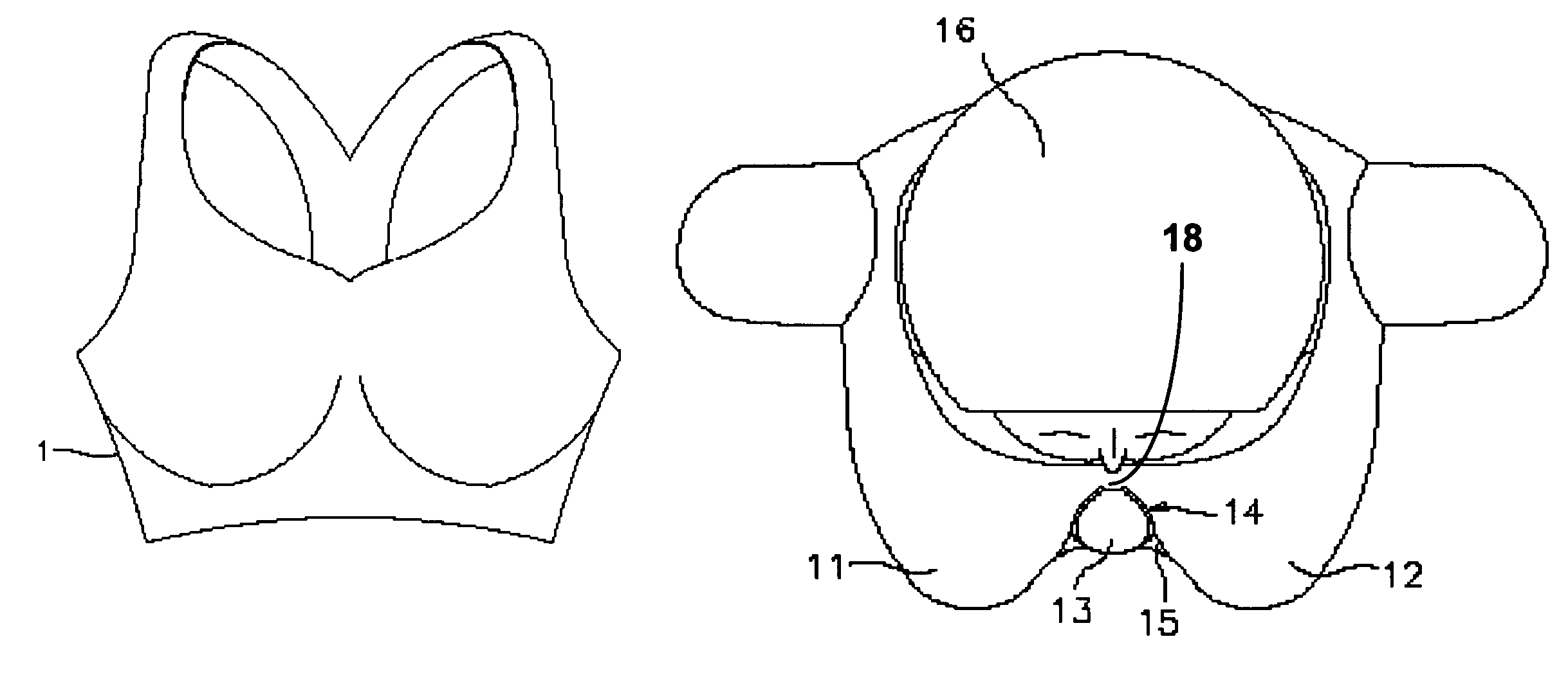 Suspension-styled brassiere primarily for minimization of intra-breast wrinkling