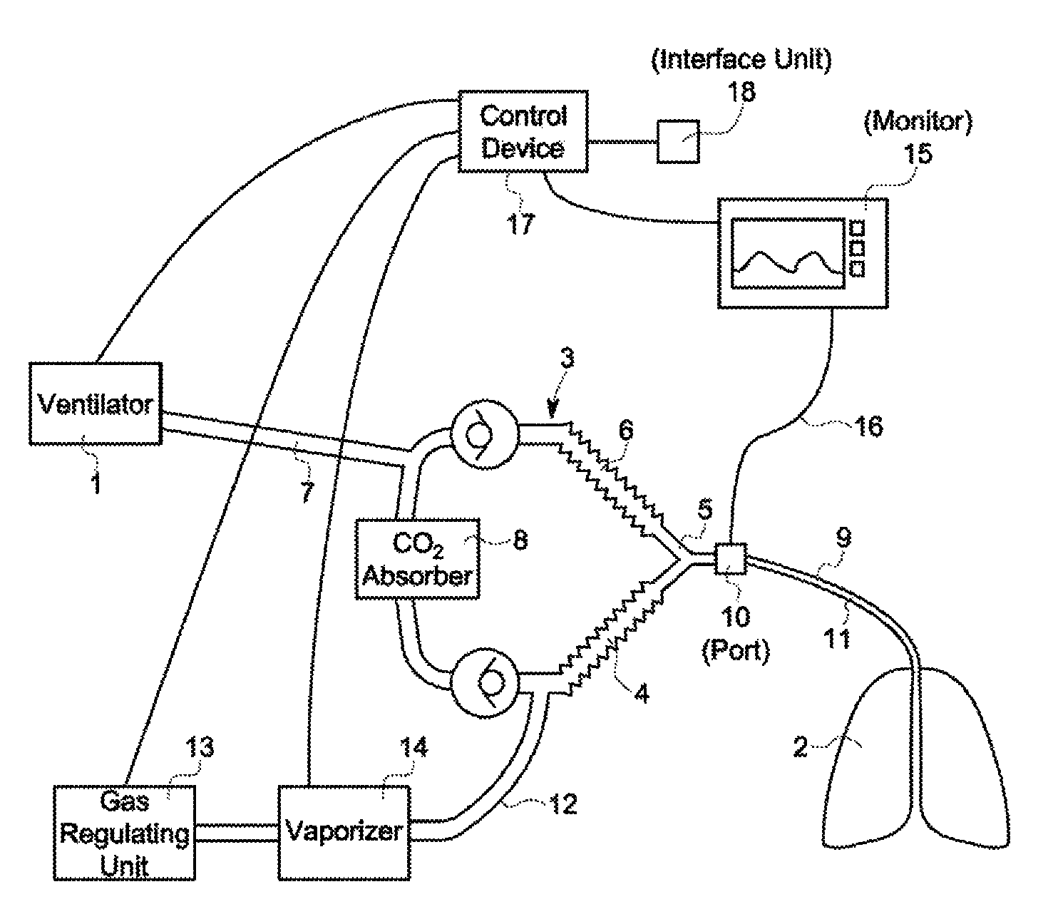 Inhalation anaesthesia delivery system and method