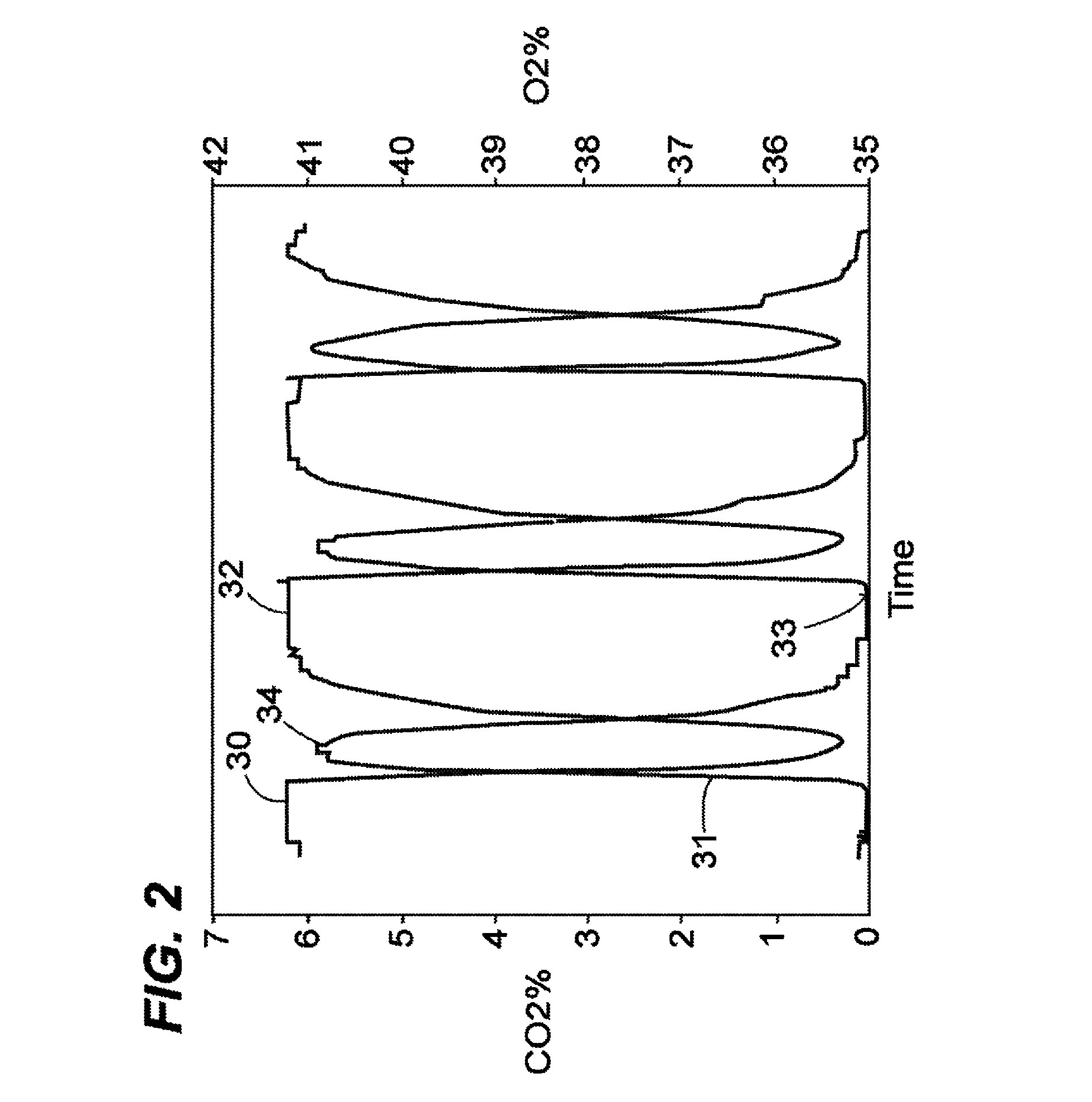 Inhalation anaesthesia delivery system and method