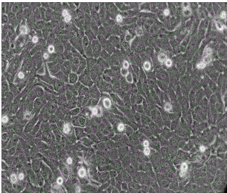 Human amniotic epithelial cell separation method