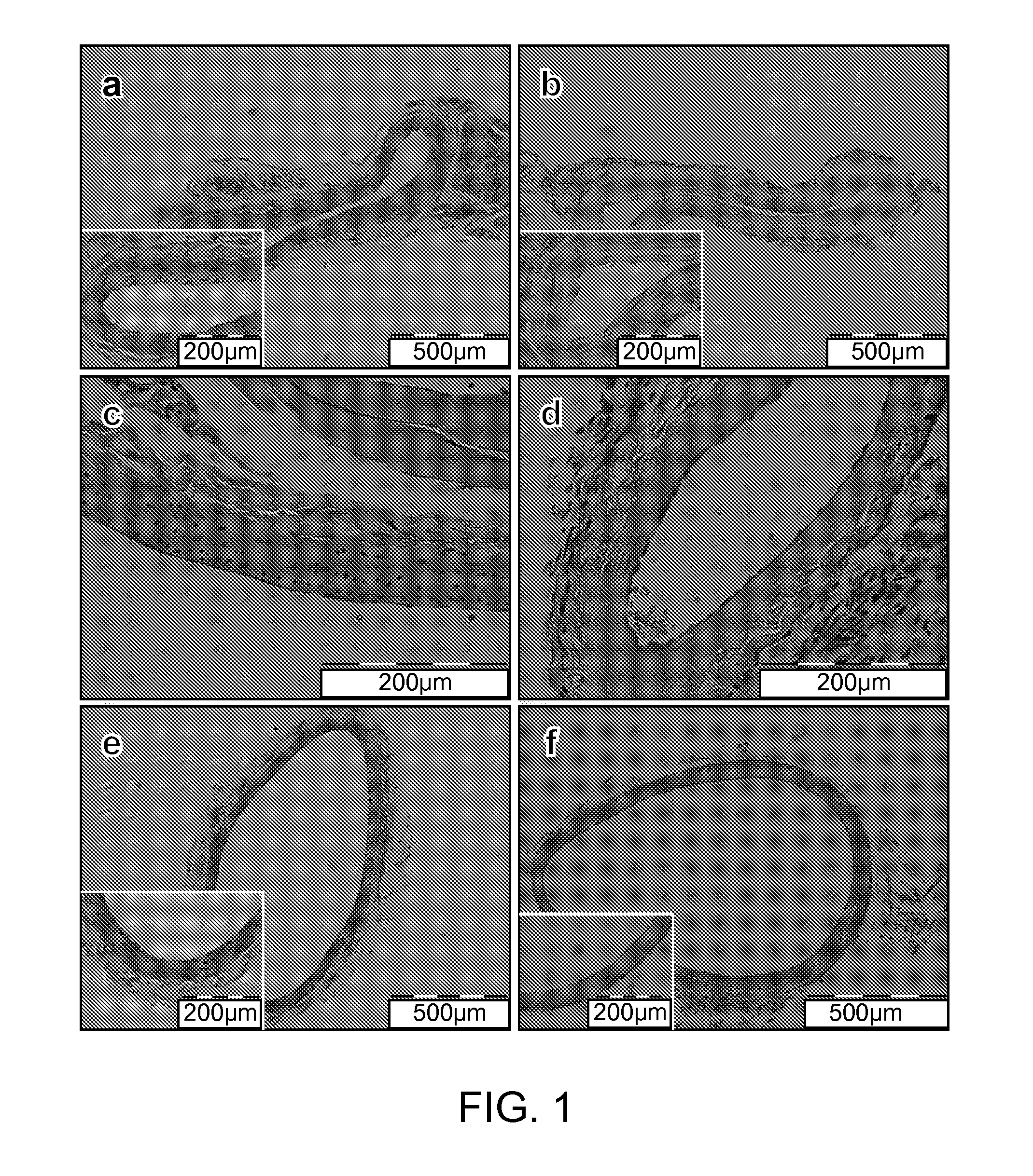 Extracellular matrix material created using non-thermal irreversible electroporation