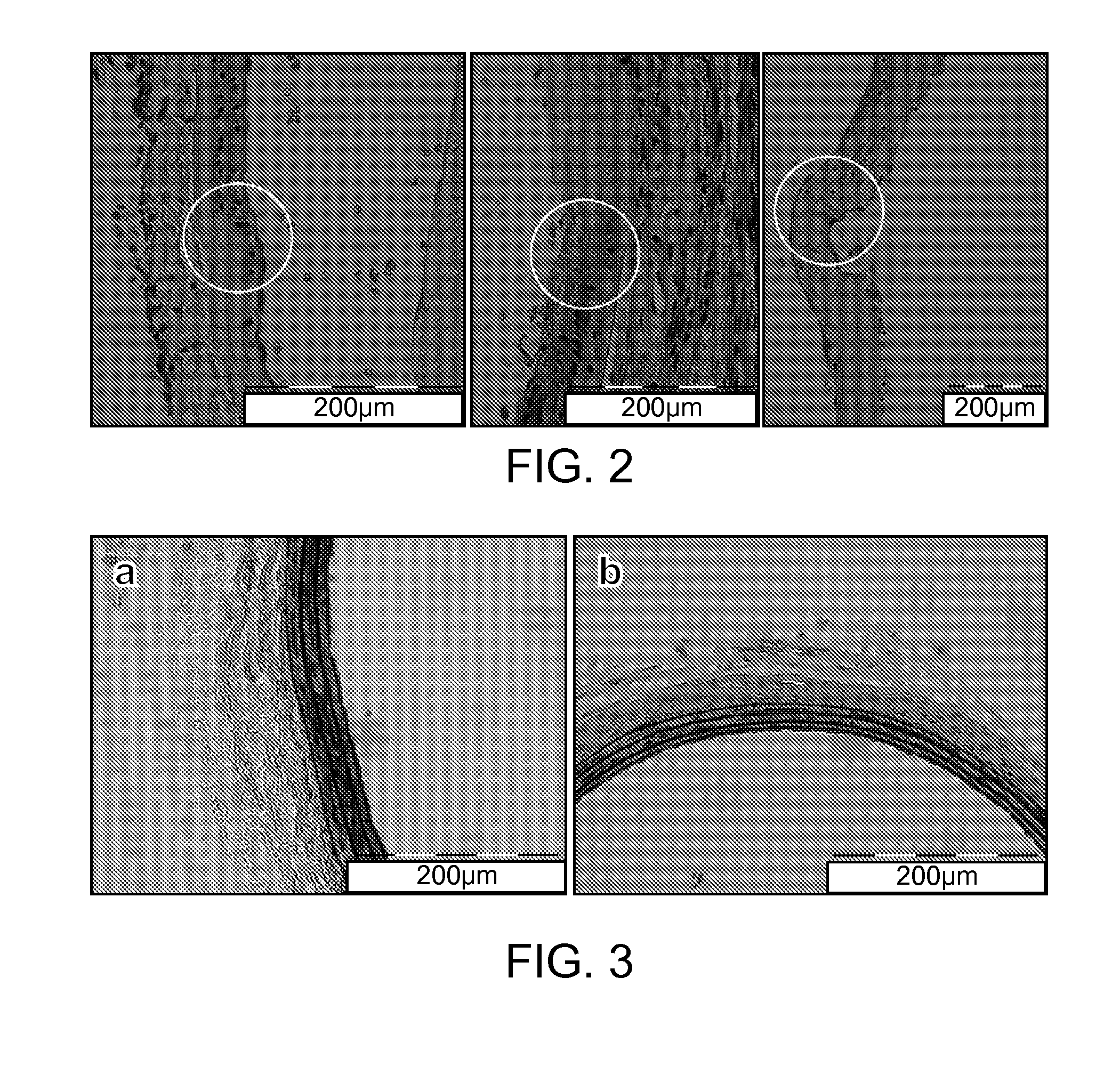 Extracellular matrix material created using non-thermal irreversible electroporation