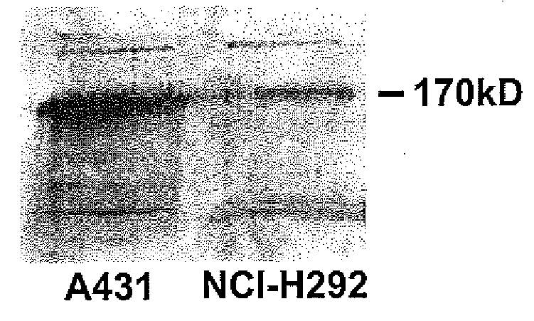 Preventing airway mucus production  by administration of egf-r antagonists