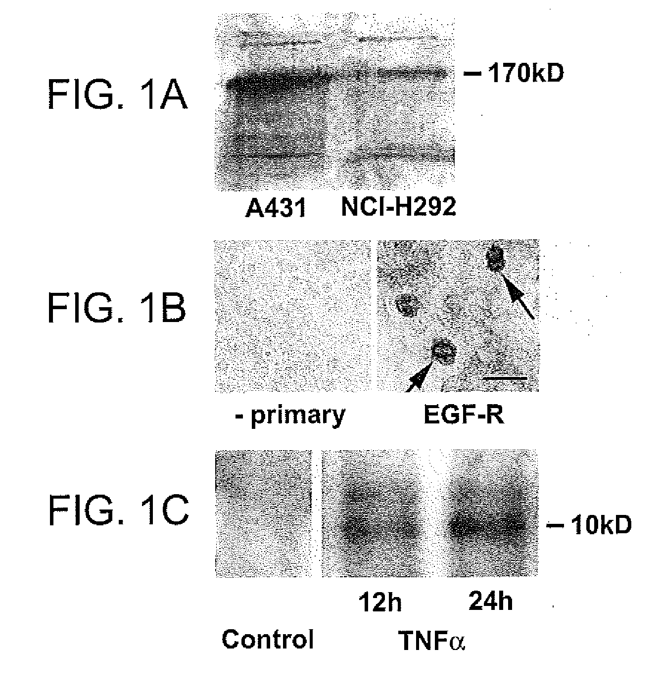 Preventing airway mucus production  by administration of egf-r antagonists