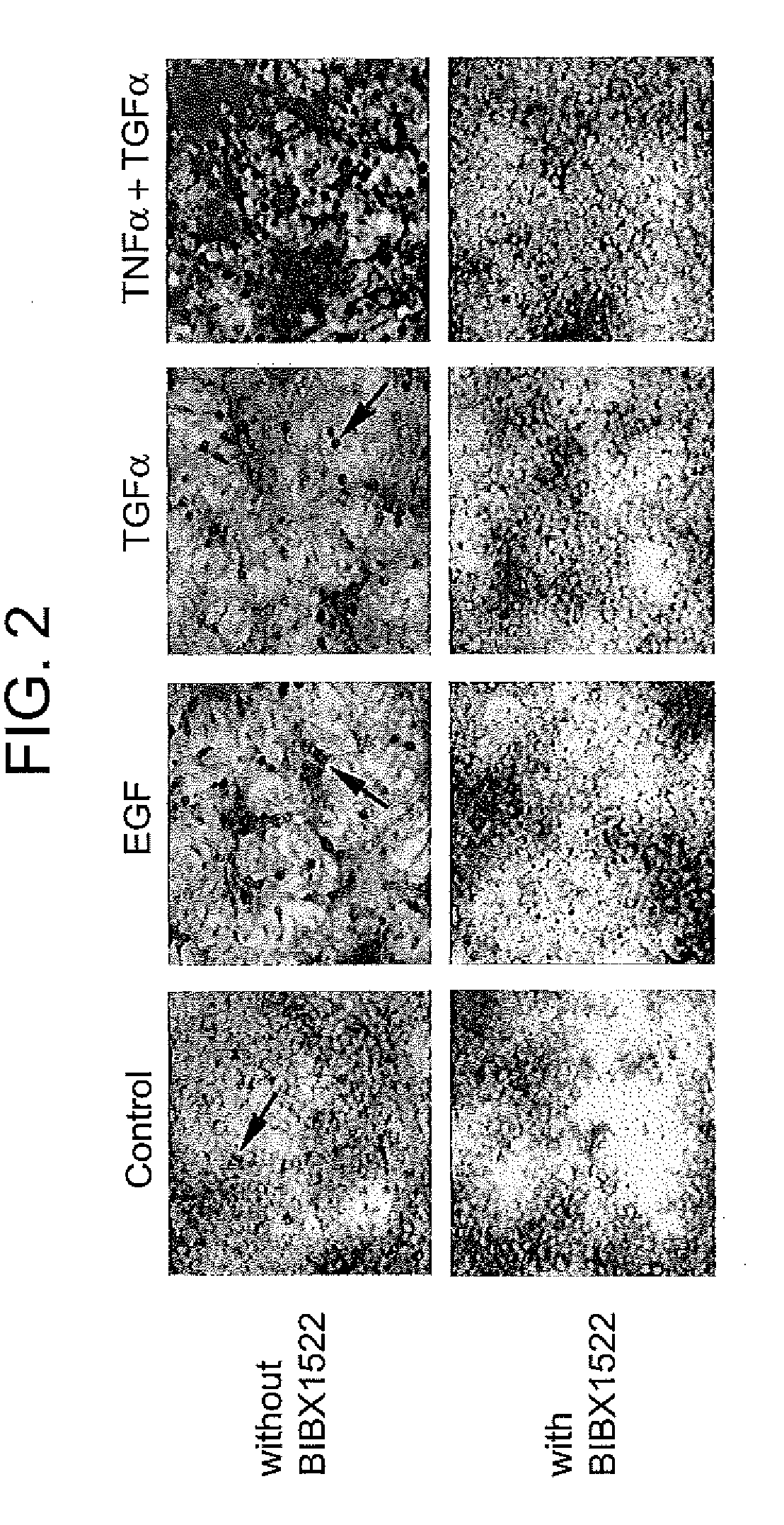 Preventing airway mucus production  by administration of egf-r antagonists