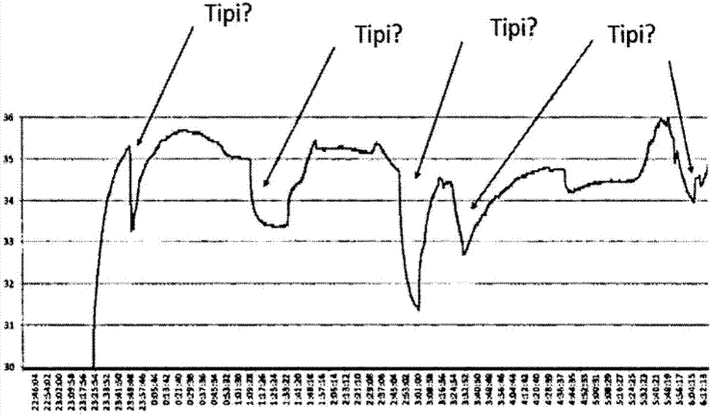 Method and apparatus for detecting body-related temperature changes