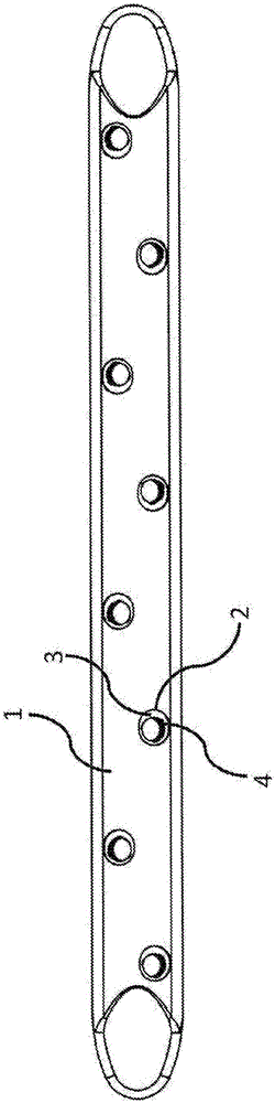 Flexible plate fixation of bone fractures