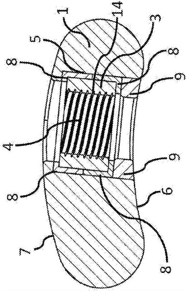 Flexible plate fixation of bone fractures