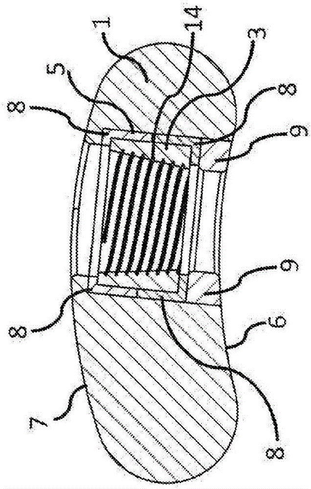 Flexible plate fixation of bone fractures