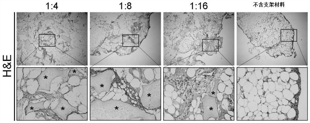 Method for direct regeneration of hypertrophic cartilage tissue using adipose tissue and scaffold material