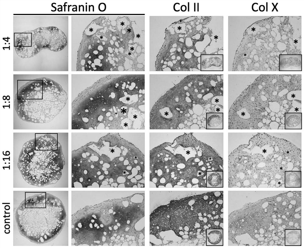 Method for direct regeneration of hypertrophic cartilage tissue using adipose tissue and scaffold material