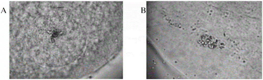 Composition for promoting meiotic resumption of oocytes of sows and application of composition