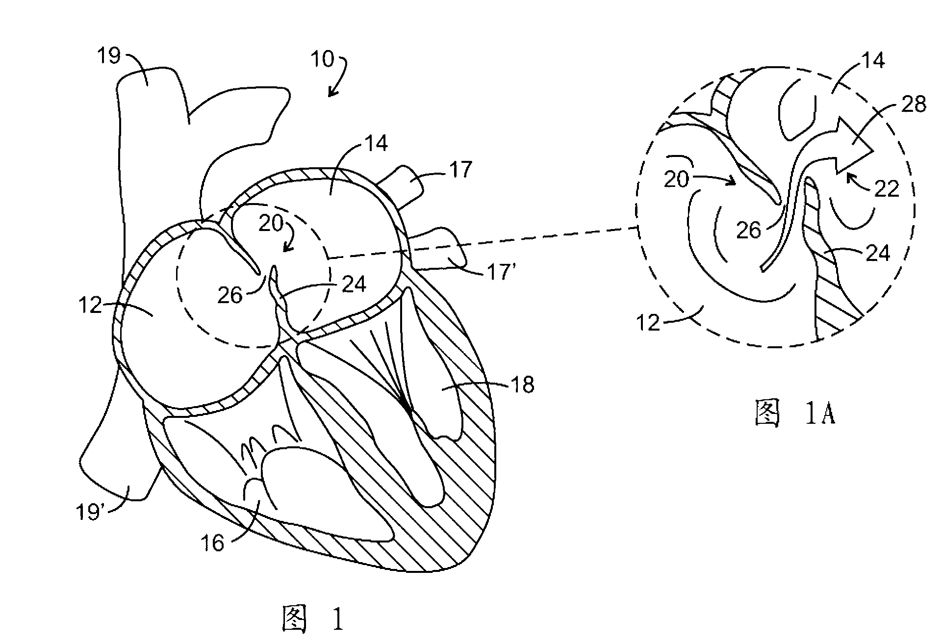 System for improved hemodynamic detection of circulatory anomalies