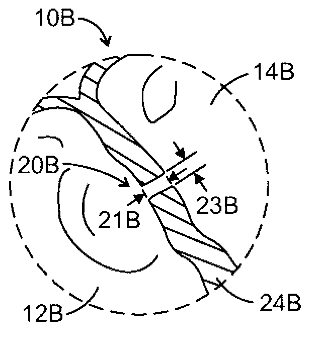 System for improved hemodynamic detection of circulatory anomalies