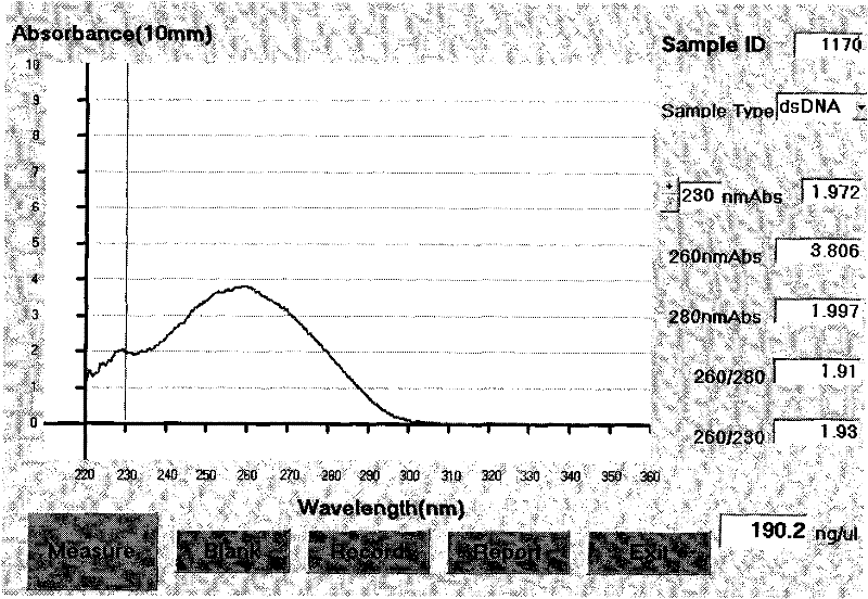 Use and detection kit of locus rs2336384 of susceptibility gene of hypertension