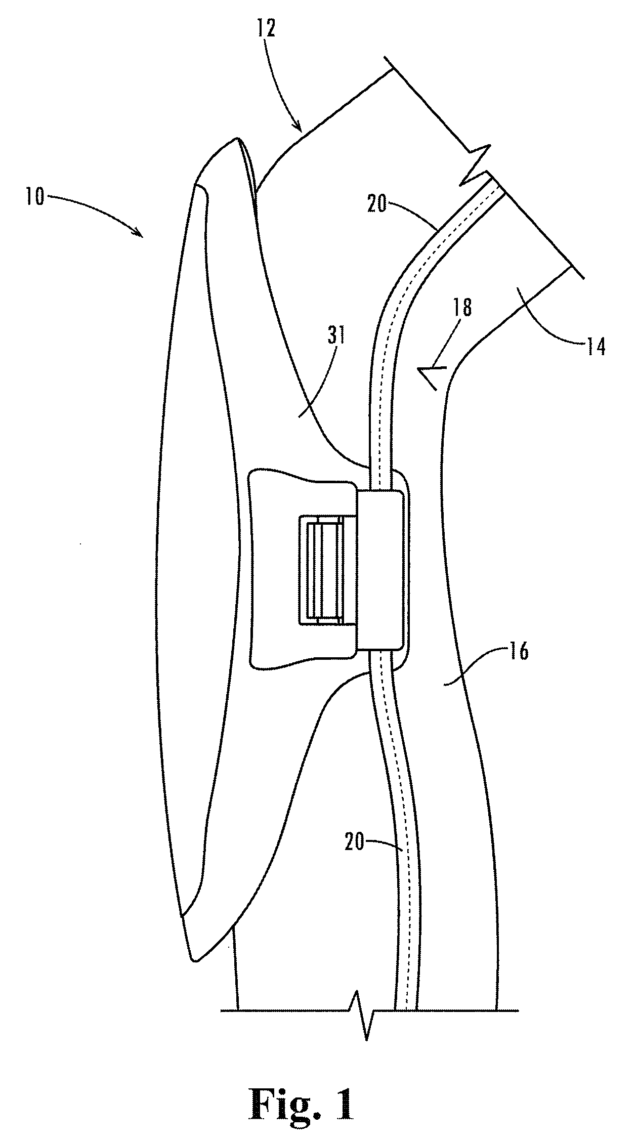 Clip-On Protective Kneepad