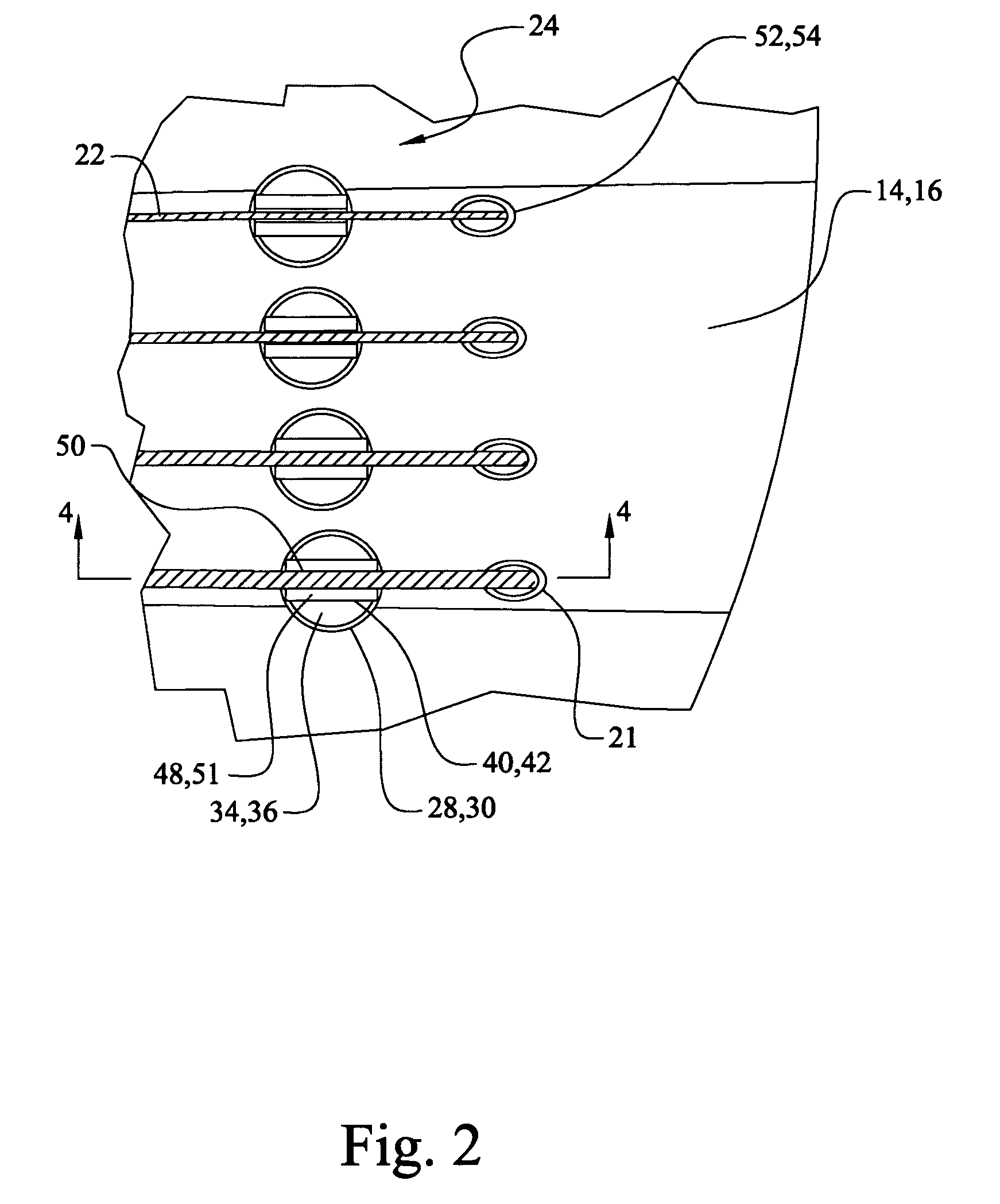 Optimally coupled string instrument bridge