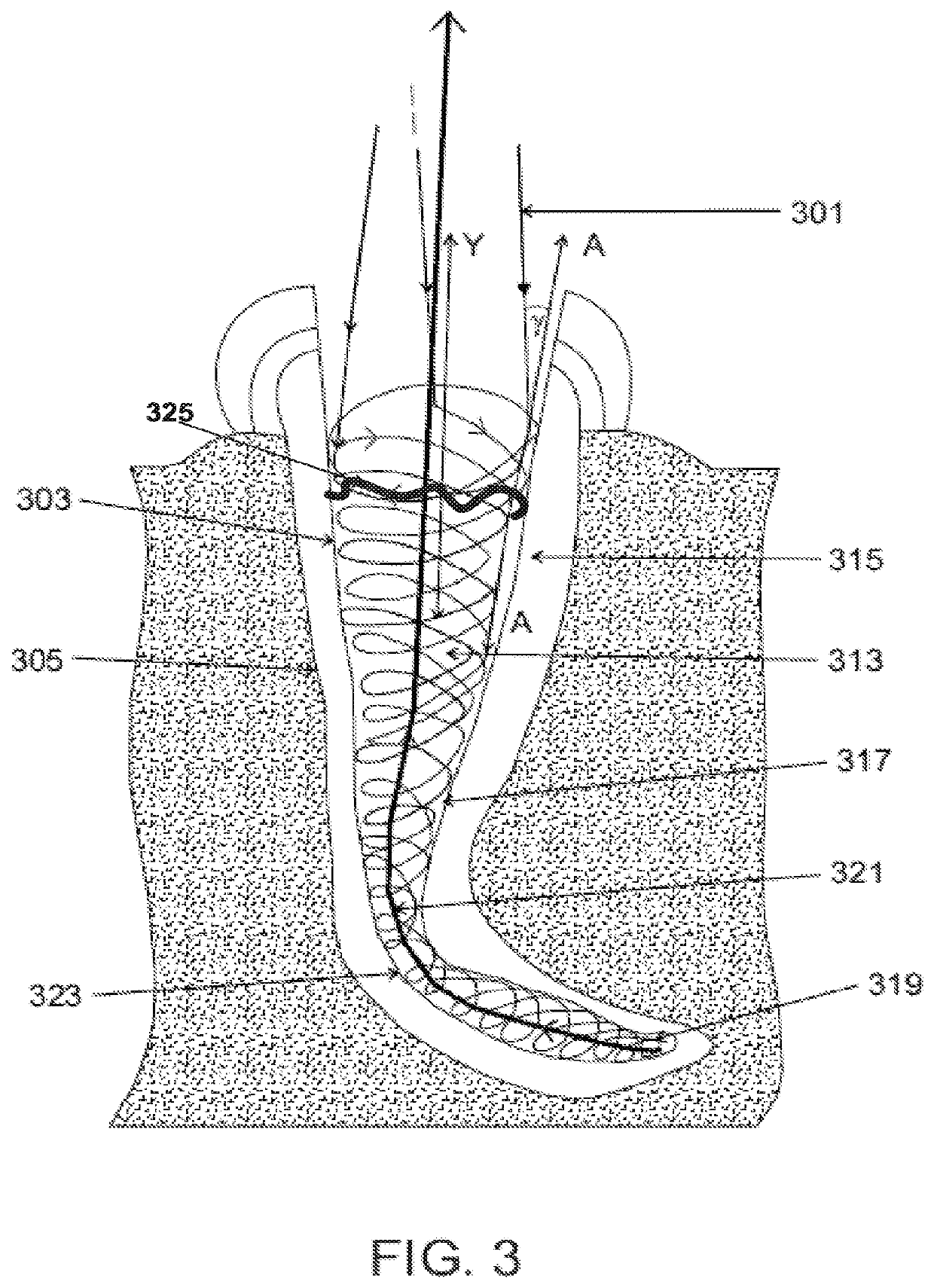 Apparatus and method for endodontic treatment