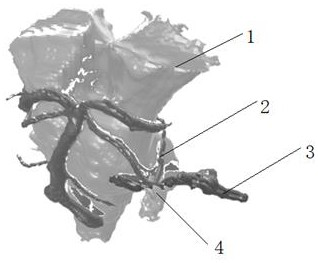 Trigeminal neuralgia model based on MR image and preparation method of trigeminal neuralgia model