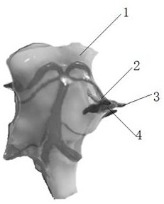 Trigeminal neuralgia model based on MR image and preparation method of trigeminal neuralgia model