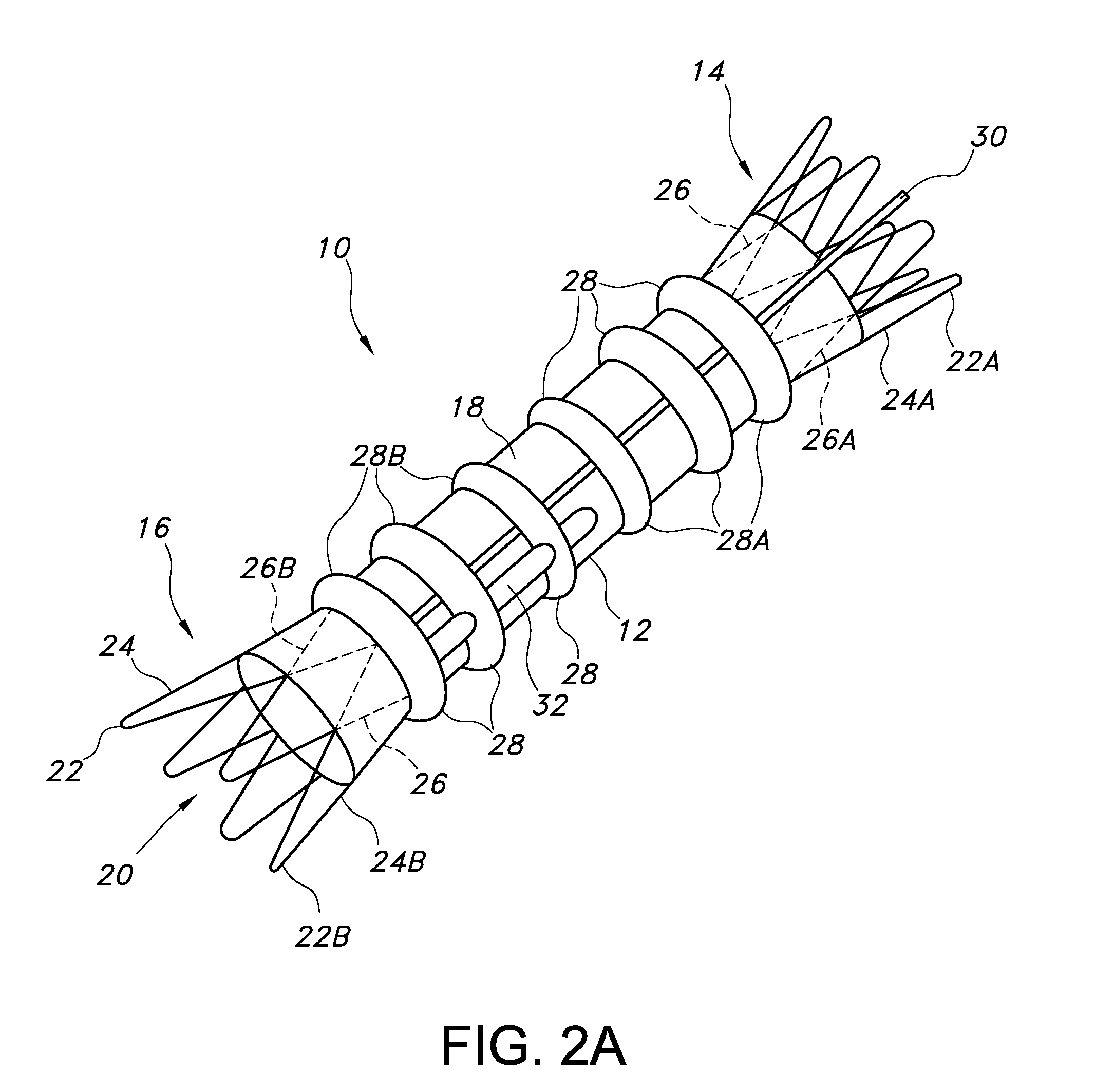 Advanced kink resistant stent graft