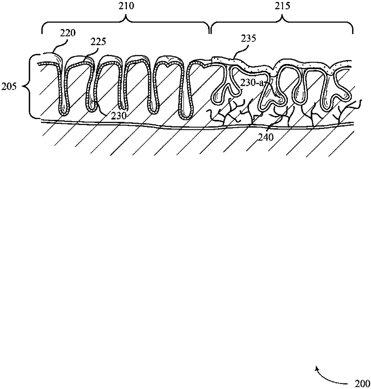 Systems and methods for ablative treatment of irritable bowel disease