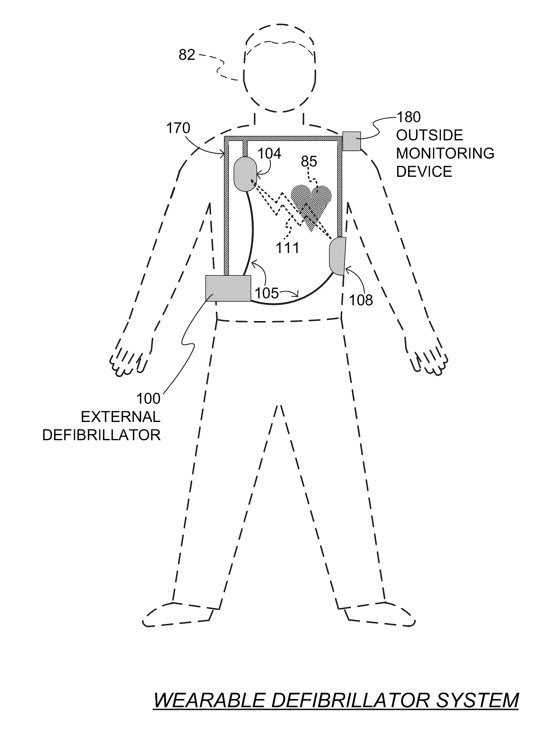 Wearable cardiac defibrillator system controlling conductive fluid deployment