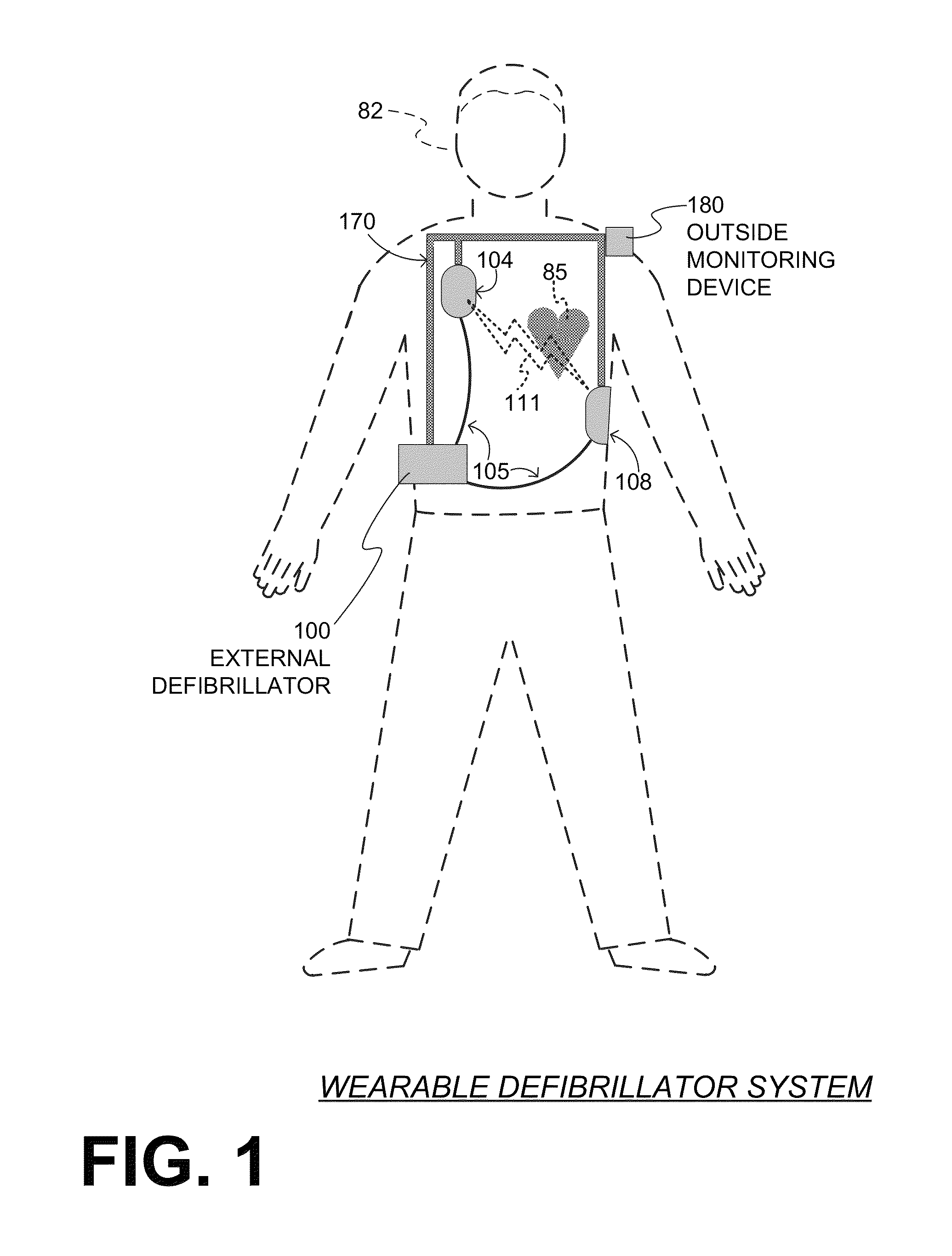 Wearable cardiac defibrillator system controlling conductive fluid deployment