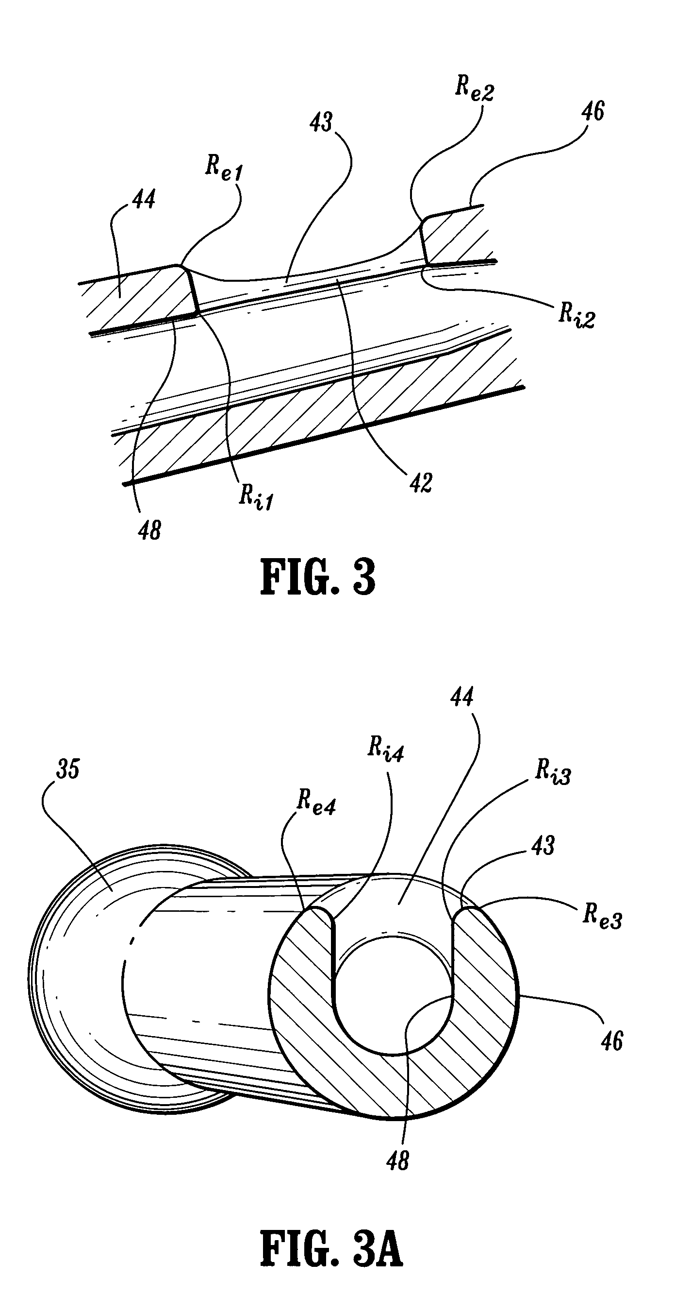 Urology catheter