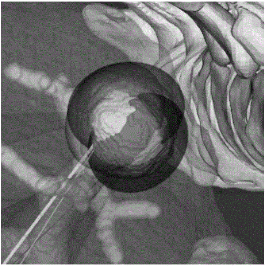 Method for precisely simulating radiofrequency ablation technology by utilizing ellipsoid to cover tumor