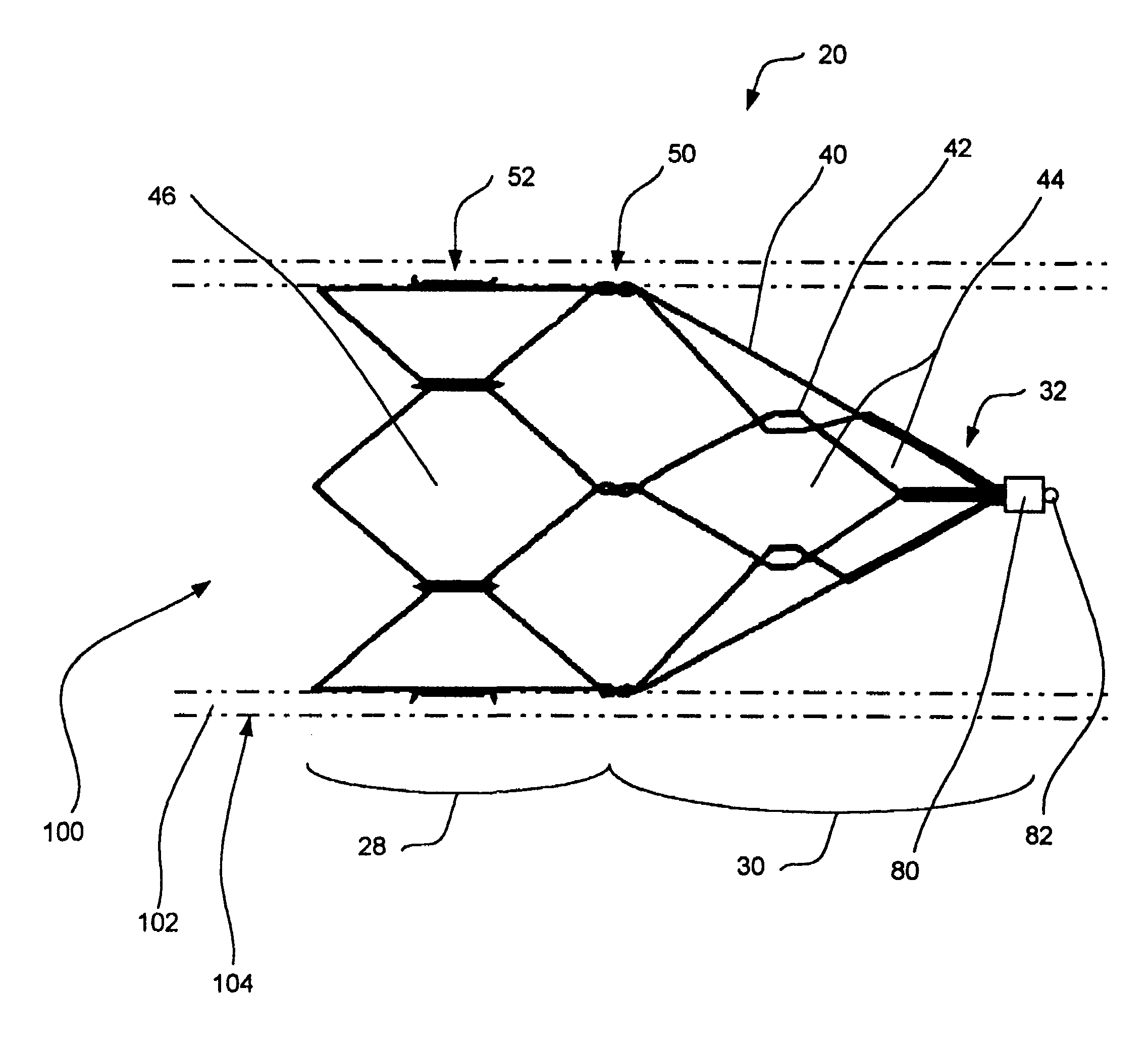 Intravascular filtering devices and methods