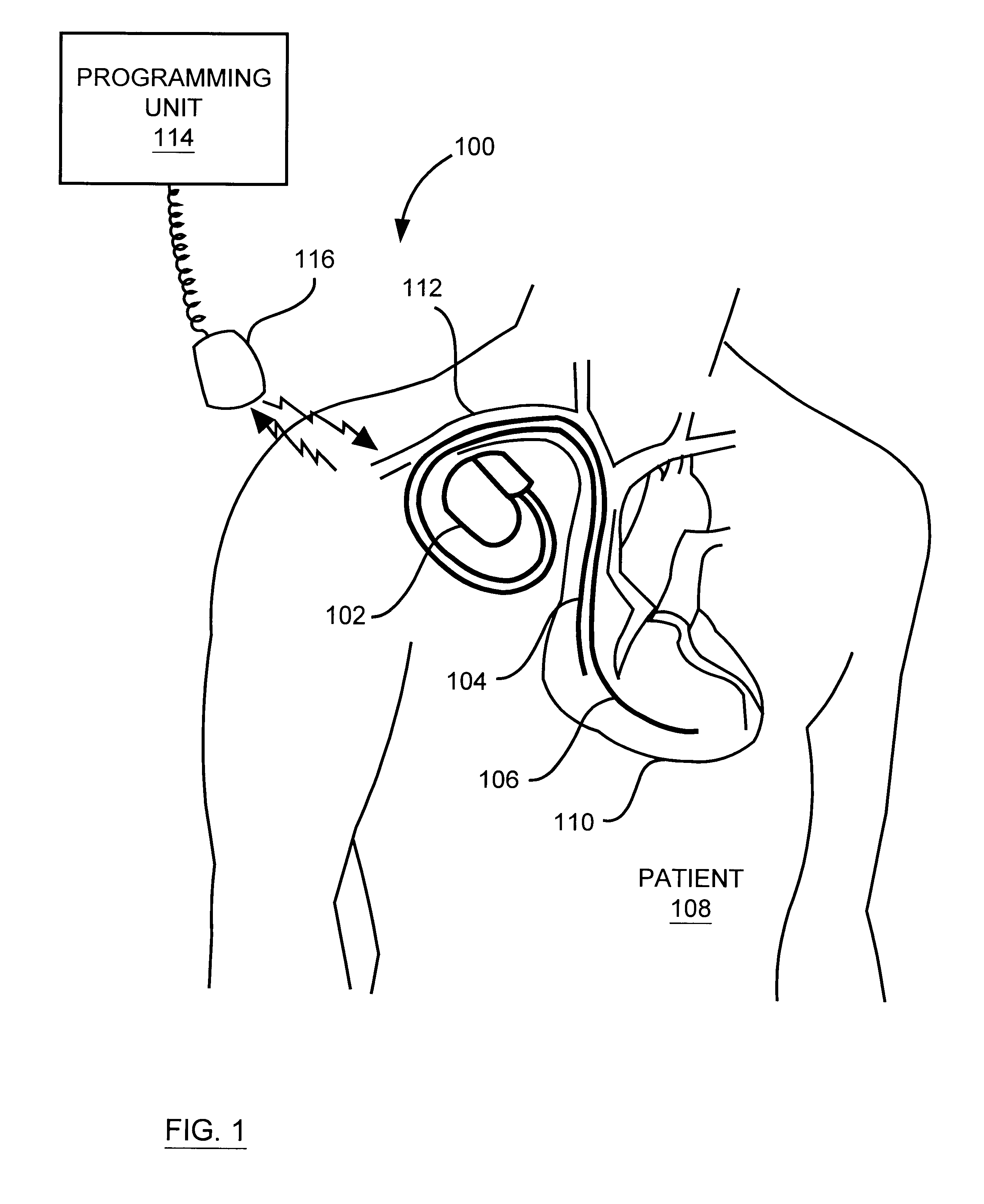 Method for providing a therapy to a patient involving modifying the therapy after detecting an onset of sleep in the patient, and implantable medical device embodying same