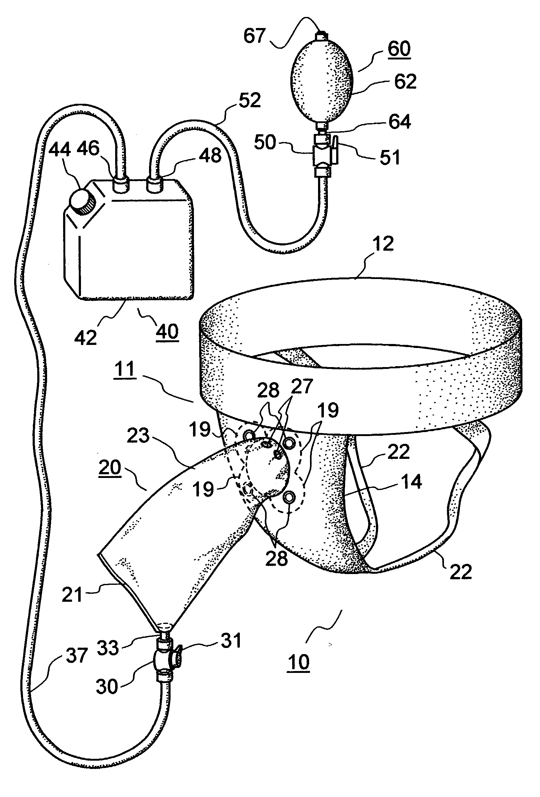 Urine collection system for males utilizing a flexible external catheter and vacuum assistance