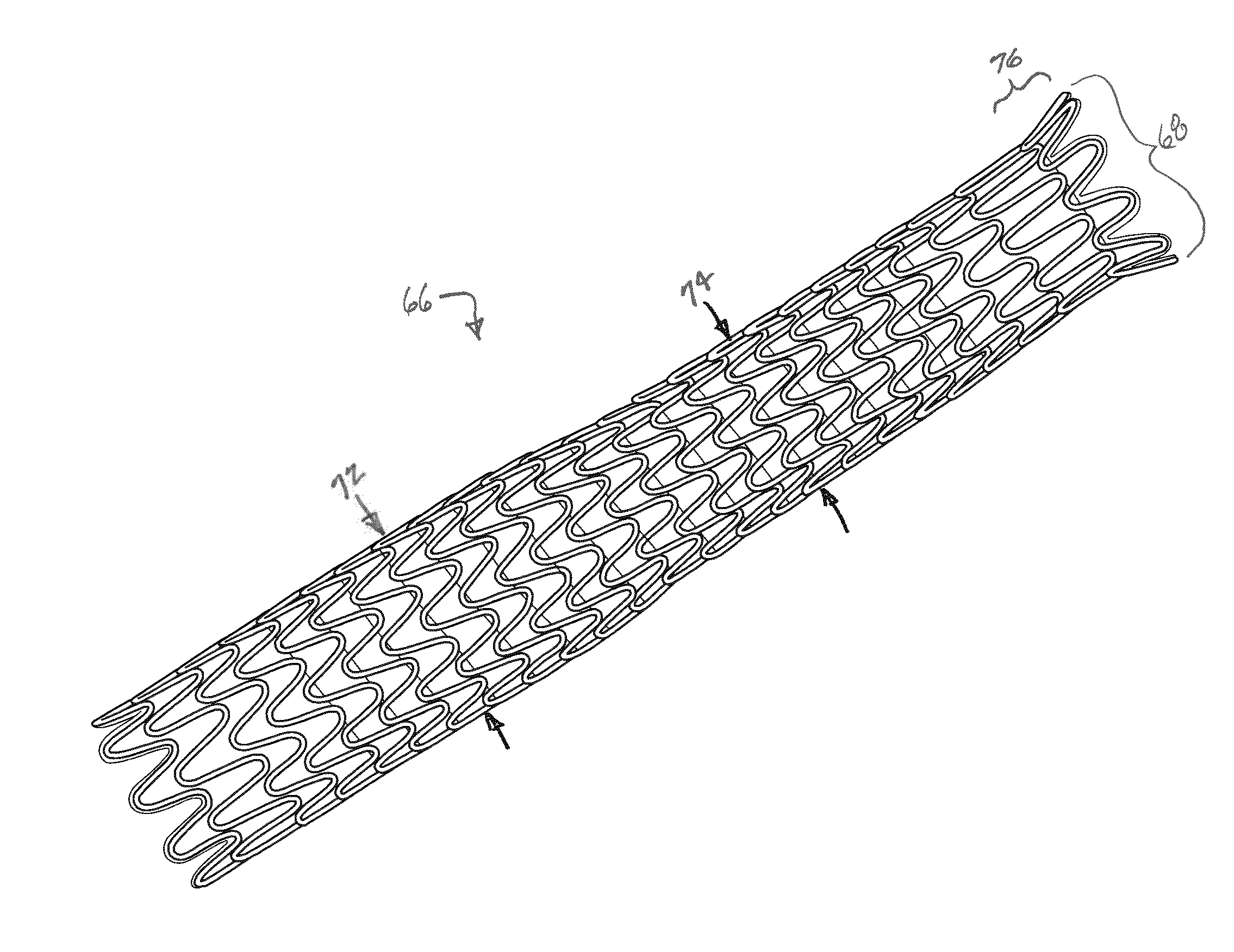 Self-expanding, balloon expandable stent-grafts