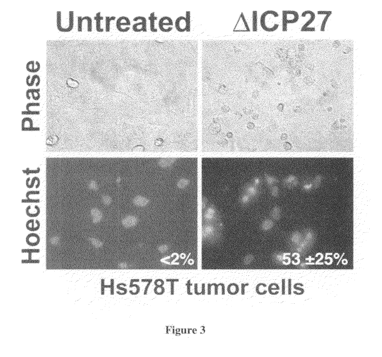 Method of determining susceptibility of a tumor cell to a chemotherapeutic agent:  novel use of herpes